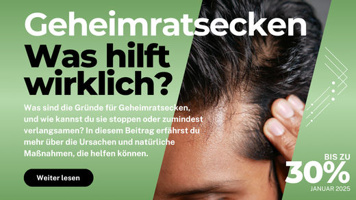Geheimratsecken bekämpfen: Was hilft wirklich?